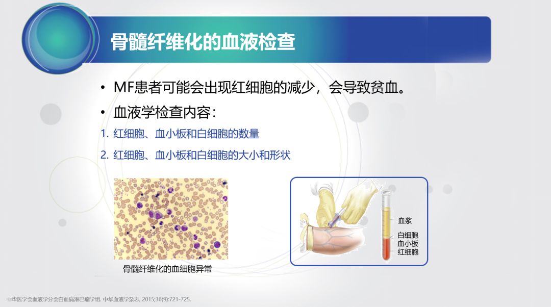 骨髓纤维化最新疗法，突破带来治疗希望